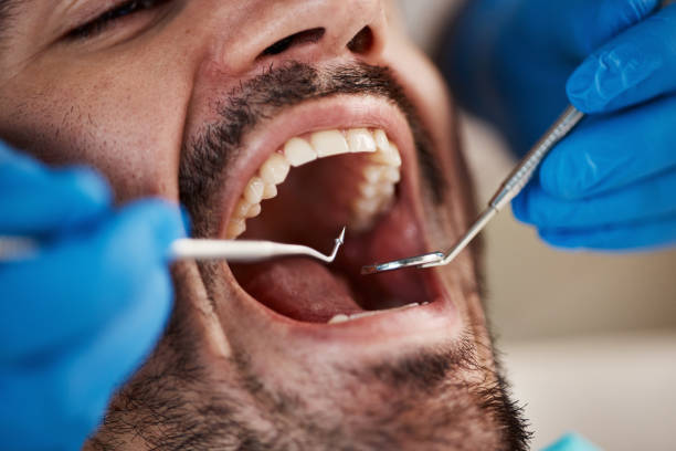 Emergency Dental Services in Lorane, PA